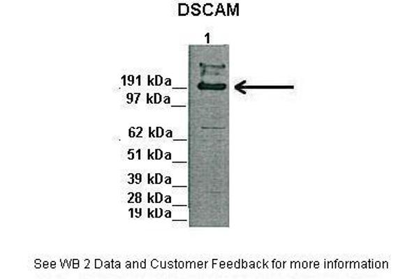 anti-Down Syndrome Cell Adhesion Molecule (DSCAM) (Middle Region) antibody