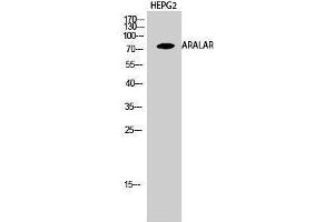 Image no. 1 for anti-Solute Carrier Family 25 (Mitochondrial Carrier, Aralar), Member 12 (Slc25a12) (Internal Region) antibody (ABIN3183346)