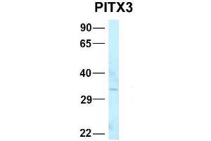 Image no. 3 for anti-Pituitary Homeobox 3 (PITX3) (N-Term) antibody (ABIN2777717)