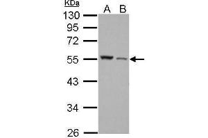 Image no. 1 for anti-Desmin (DES) (Center) antibody (ABIN2855655)