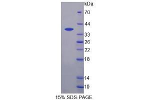 Image no. 1 for 3'(2'), 5'-Bisphosphate Nucleotidase 1 (BPNT1) (AA 7-308) protein (His tag) (ABIN6239460)