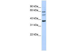 Image no. 1 for anti-UDP Glucuronosyltransferase 1 Family, Polypeptide A9 (UGT1A9) (N-Term) antibody (ABIN636089)