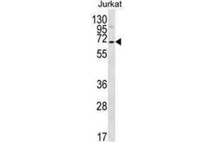 PSAPL1 antibody  (N-Term)