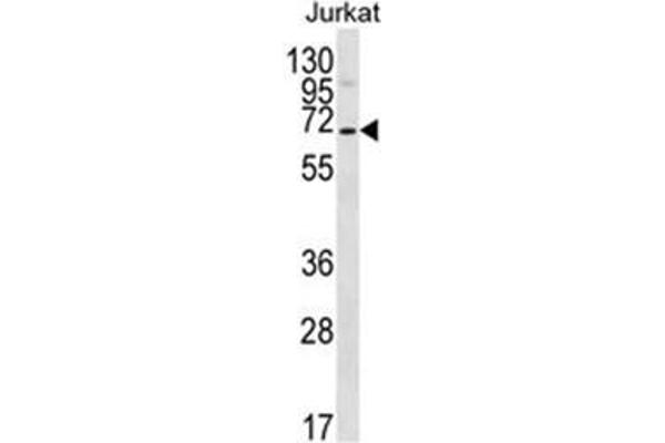 PSAPL1 antibody  (N-Term)