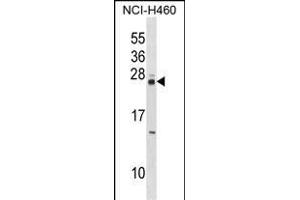 MOBKL3 Antibody (N-term) (ABIN1538807 and ABIN2848562) western blot analysis in NCI- cell line lysates (35 μg/lane).