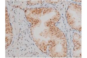 Image no. 6 for anti-Jun D Proto-Oncogene (JUND) (pSer255) antibody (ABIN6255135)