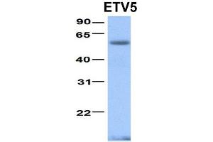 Image no. 2 for anti-Ets Variant 5 (ETV5) (N-Term) antibody (ABIN2780594)