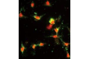 Image no. 4 for anti-Chemokine (C-C Motif) Ligand 2 (CCL2) antibody (ABIN2158090)