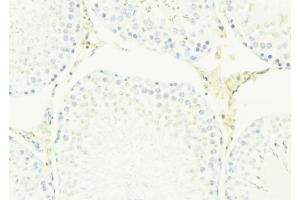 Image no. 2 for anti-Coxsackie Virus and Adenovirus Receptor (CXADR) (N-Term) antibody (ABIN6261118)