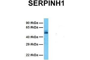 Image no. 5 for anti-serpin Peptidase Inhibitor, Clade H (Heat Shock Protein 47), Member 1, (Collagen Binding Protein 1) (SERPINH1) (C-Term) antibody (ABIN2792207)