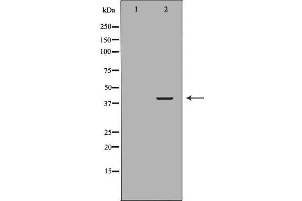 anti-Neutrophil Cytosolic Factor 4, 40kDa (NCF4) (C-Term) antibody