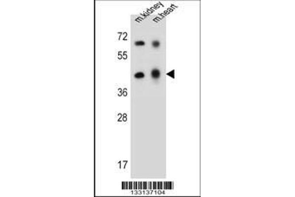 anti-Adenosine Deaminase-Like Protein (ADAL) (AA 317-344), (C-Term) antibody