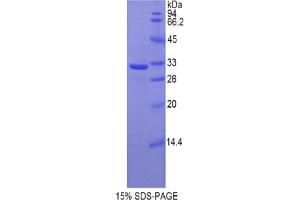 Image no. 1 for Hyaluronan Synthase 1 (HAS1) protein (ABIN3009895)