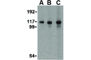 Image no. 2 for anti-Interferon Induced with Helicase C Domain 1 (IFIH1) (C-Term) antibody (ABIN6655946)