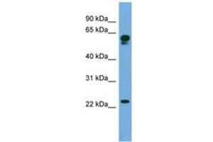 Image no. 1 for anti-Chromosome 14 Open Reading Frame 126 (C14orf126) (AA 71-120) antibody (ABIN6745654)