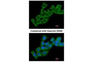 Image no. 1 for anti-Calcium Binding Protein P22 (CHP) (Internal Region) antibody (ABIN2856827)