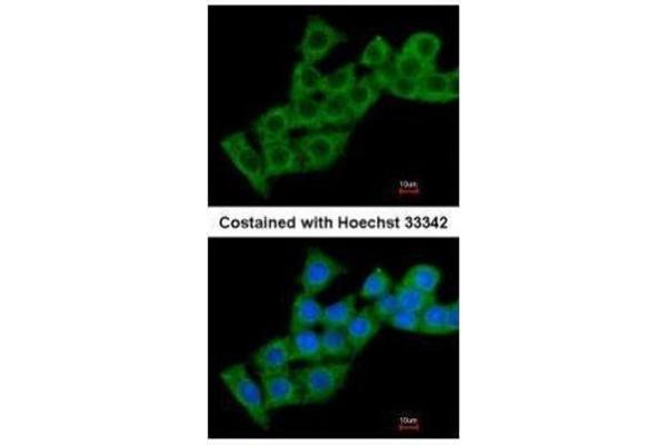 anti-Calcium Binding Protein P22 (CHP) (Internal Region) antibody
