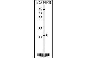 anti-Ras-Related GTP Binding D (RRAGD) (AA 171-199) antibody