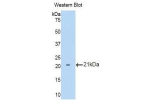 Image no. 1 for anti-Interleukin 12 Receptor, beta 2 (IL12RB2) (AA 455-606) antibody (ABIN1859337)
