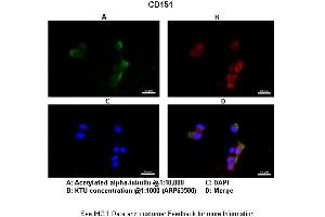 Image no. 2 for anti-CD151 (CD151) (C-Term) antibody (ABIN2789524)