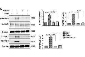 Image no. 4 for anti-SMAD, Mothers Against DPP Homolog 3 (SMAD3) (AA 417-425), (pSer423), (pSer425) antibody (ABIN129675)