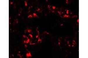Immunofluorescence of FOXRED2 in human lung cells with FOXRED2 antibody at 20 ug/mL.