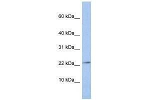 JAM3 antibody used at 1 ug/ml to detect target protein.