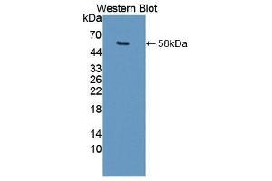 anti-Matrix Metallopeptidase 15 (Membrane-inserted) (MMP15) (AA 280-497) antibody