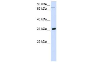 Image no. 1 for anti-Uridine Phosphorylase 1 (UPP1) antibody (ABIN2458626)