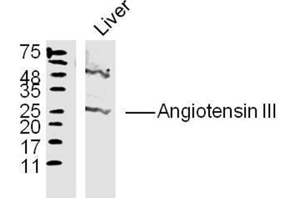 anti-Angiotensin III (AGT3) (AA 35-41) antibody