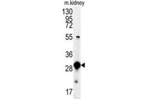 Image no. 2 for anti-Mercaptopyruvate Sulfurtransferase (MPST) antibody (ABIN3003390)