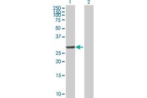 Image no. 1 for anti-Ral GEF with PH Domain and SH3 Binding Motif 1 (RALGPS1) (AA 1-305) antibody (ABIN523142)