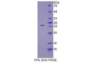 Image no. 1 for Interleukin 1 alpha (IL1A) (AA 94-262) protein (His tag) (ABIN6238580)