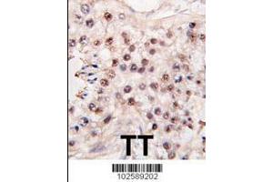 Image no. 3 for anti-Histone Deacetylase 11 (HDAC11) (AA 313-345), (C-Term) antibody (ABIN387965)
