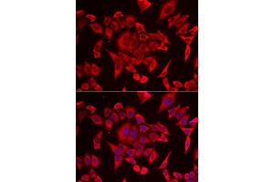 Image no. 2 for anti-Solute Carrier Family 20 (Phosphate Transporter), Member 2 (SLC20A2) antibody (ABIN2559952)