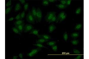 Immunofluorescence of monoclonal antibody to SET7 on HeLa cell.