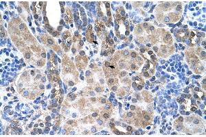 Image no. 2 for anti-Solute Carrier Family 6, Member 18 (SLC6A18) (Middle Region) antibody (ABIN2781744)