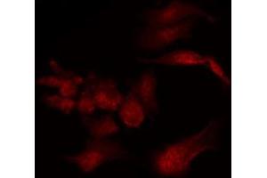 Image no. 2 for anti-Protein Phosphatase 1, Regulatory (Inhibitor) Subunit 1B (PPP1R1B) antibody (ABIN6261225)