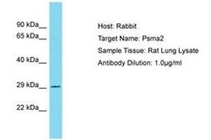 Image no. 1 for anti-Proteasome Subunit alpha 2 (PSMA2) (AA 122-171) antibody (ABIN6750359)