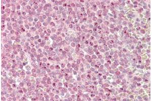 Image no. 1 for anti-Myeloid/lymphoid Or Mixed-Lineage Leukemia 2 (MLL2) (AA 2-14) antibody (ABIN1494780)