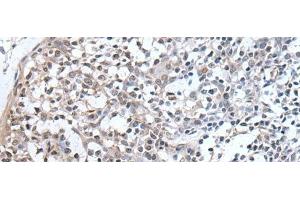 Immunohistochemistry of paraffin-embedded Human tonsil tissue using PLAG1 Polyclonal Antibody at dilution of 1:25(x200)