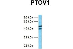Image no. 2 for anti-Prostate Tumor Overexpressed 1 (PTOV1) (N-Term) antibody (ABIN2784251)