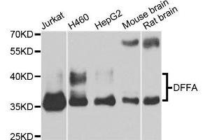 Image no. 1 for anti-DNA Fragmentation Factor, 45kDa, alpha Polypeptide (DFFA) antibody (ABIN6139548)