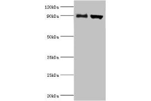 ADAM9 Antikörper  (AA 475-685)