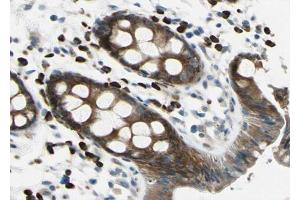 Image no. 3 for anti-Adenomatous Polyposis Coli (APC) (pSer2054) antibody (ABIN6255083)