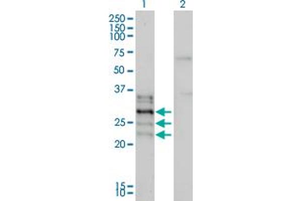 anti-Nuclear Factor of Activated T-Cells, Cytoplasmic, Calcineurin-Dependent 2 Interacting Protein (NFATC2IP) (AA 1-138) antibody