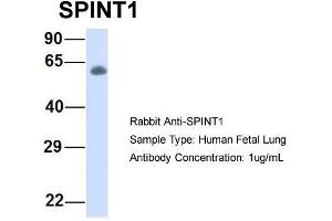 Image no. 3 for anti-serine Peptidase Inhibitor, Kunitz Type 1 (SPINT1) (Middle Region) antibody (ABIN2782016)