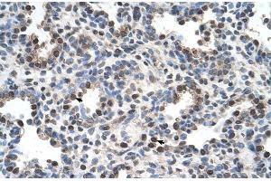 Image no. 2 for anti-Family with Sequence Similarity 134, Member B (FAM134B) (Middle Region) antibody (ABIN2782026)