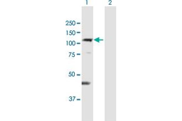 DIS3L anticorps  (AA 1-971)