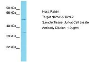 Image no. 1 for anti-Adenosylhomocysteinase-Like 2 (AHCYL2) (AA 50-99) antibody (ABIN6750591)